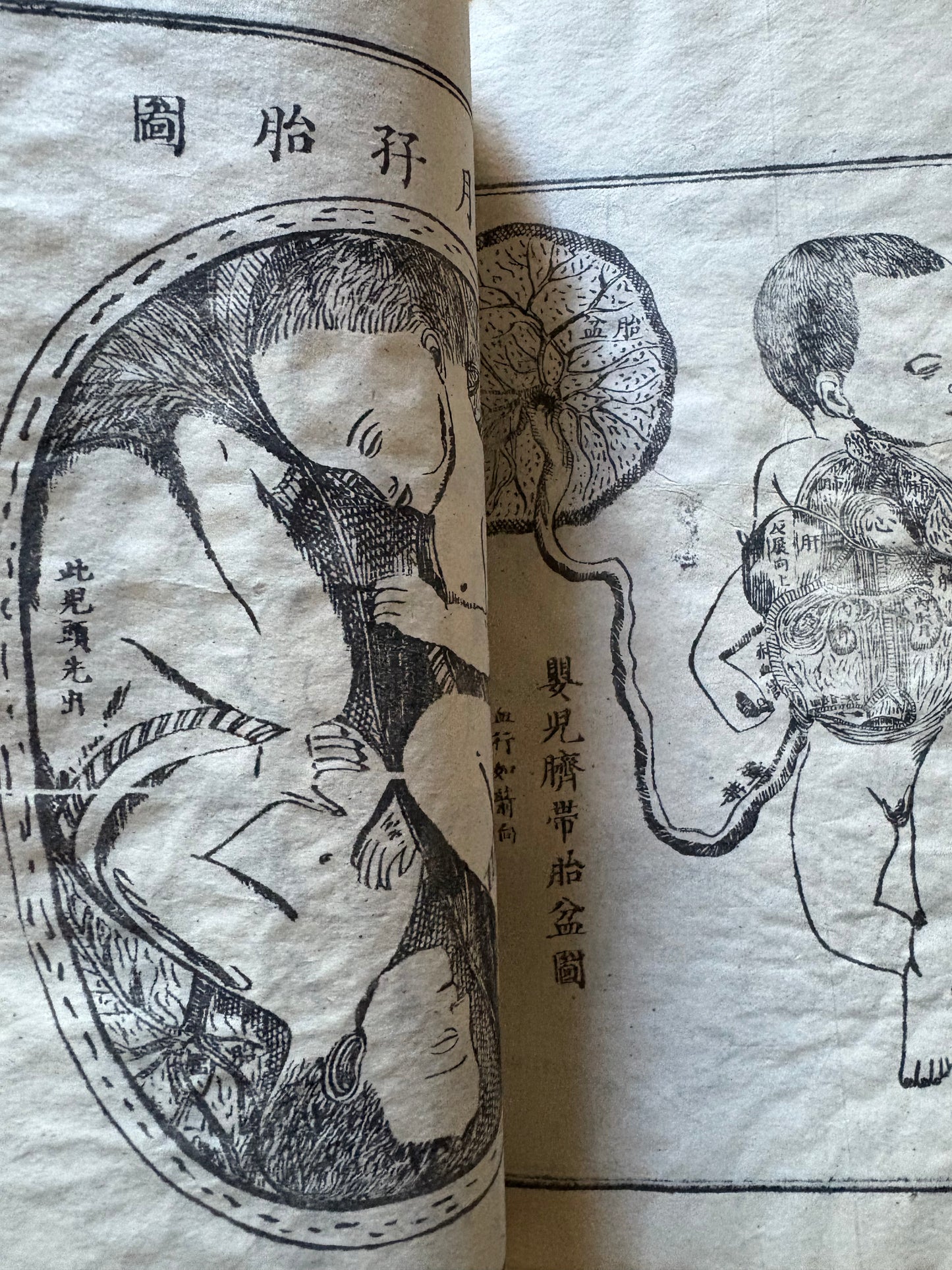 "Quan Ti Xin Lun" - A New treatise on Human Anatomy - 1853 issue - Canton (Guangzhou) - Benjamin Hobson and Chen Xiutang